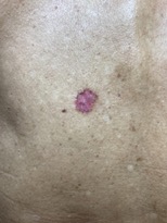 45D3E16E-AADB-491F-85D3-D16C1B8CFA56_1_105_c